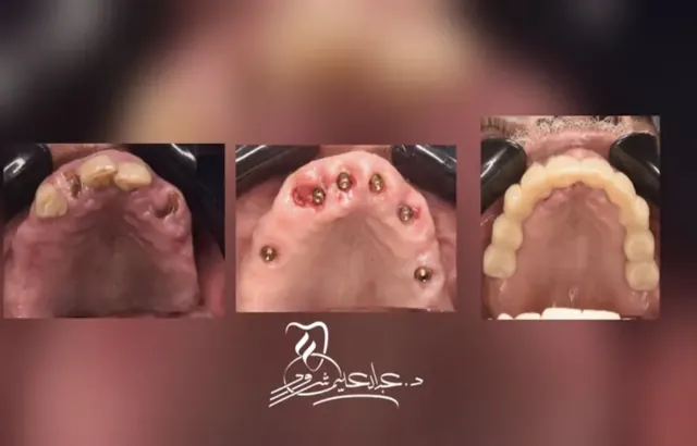 صورة من حالات الدكتور
